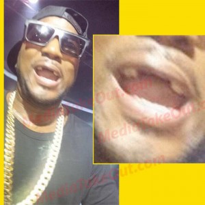 Jeezy’s Front Teeth Fell Out During A Live Performance