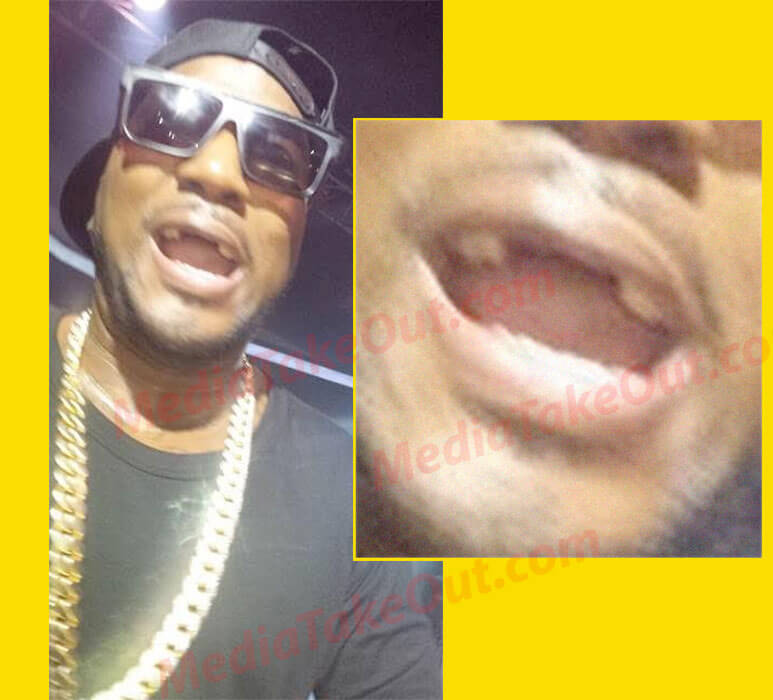 Jeezy’s Front Teeth Fell Out During A Live Performance