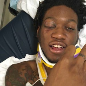 OG Maco Hospitalised After Car Accident
