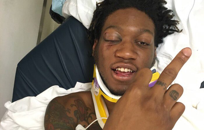 OG Maco Hospitalised After Car Accident