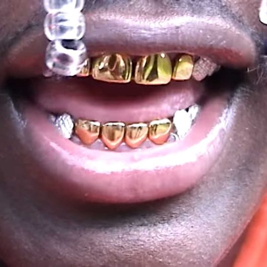 Lil Yachty & Future - Pardon Me